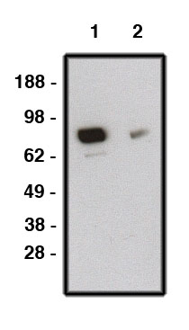 "
Western blot using SMO antibody (Cat. No. X2376P) on human brain lysate (Cat. No. X1633C).  Lysate loaded at 15µg/lane.  Antibody used at 10 µg/ml (1) and 5 µg/ml (2) dilution.  Secondary antibody, mouse anti-rabbit-HRP (Cat. No. X1207M), used at 1:150K dilution."